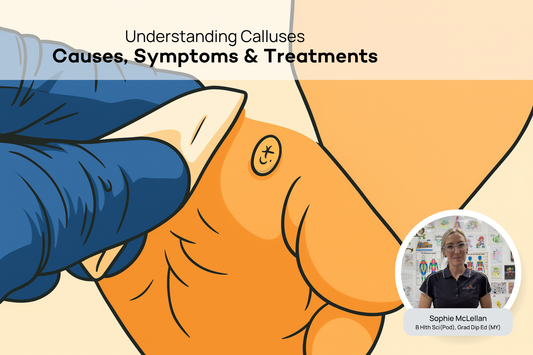Calluses - Podiatry Corner