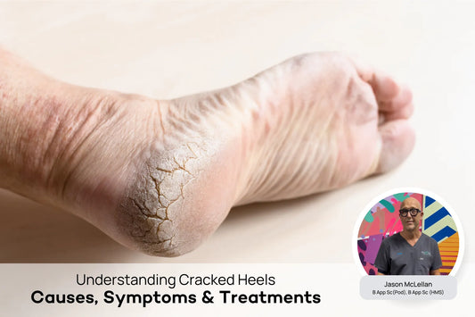 Cracked Heels - Podiatry Corner
