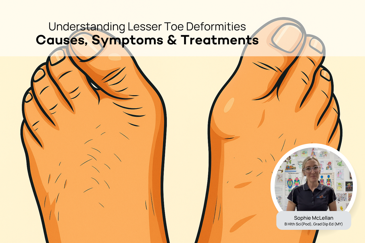 Wedge Toe Defect What are Lesser Toe Deformities? A Podiatrist Explains the Causes and ...