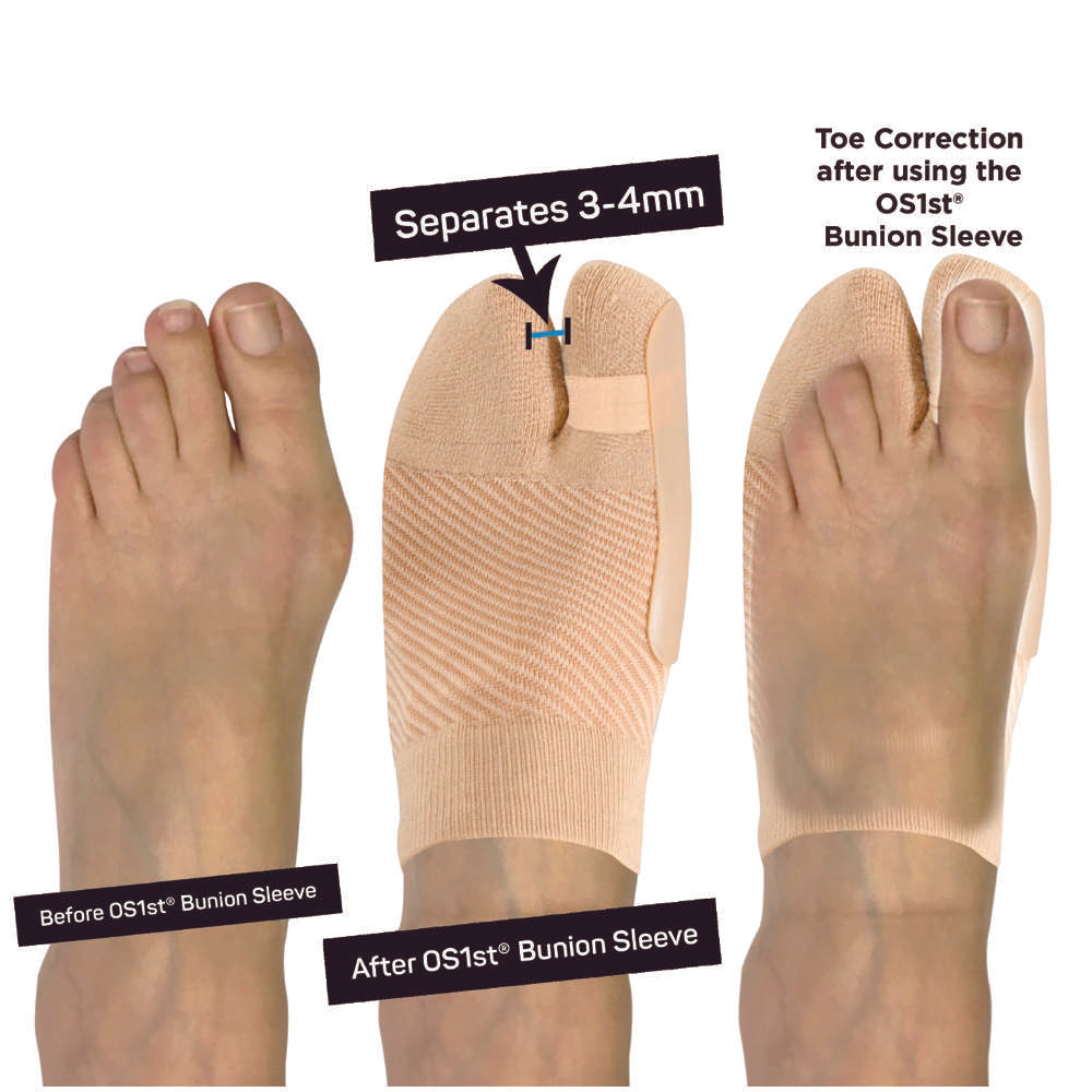 Bunion Bracing Sleeve (HV3) - Natural
